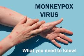 Delhi 1st Monkeypox Case: 31-Year-Old Man With No Foreign Travel History